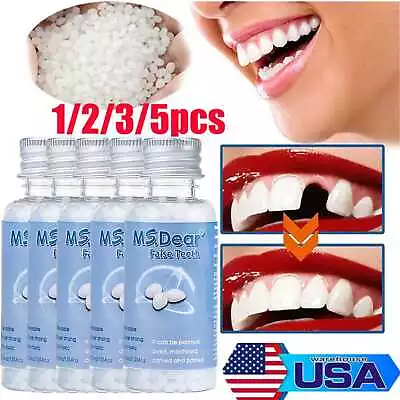 5/3x Tooth Repair Granules Temporary Reusable Moldable False Teeth Fitting Beads • $10.28