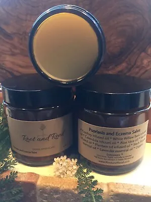 Psoriasis And Eczema Salve - All Natural - • $24