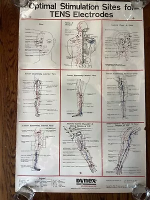 Vintage 1980 Dynex Neurostimulator Stimulation Electrodes Medical Chart Poster • $39