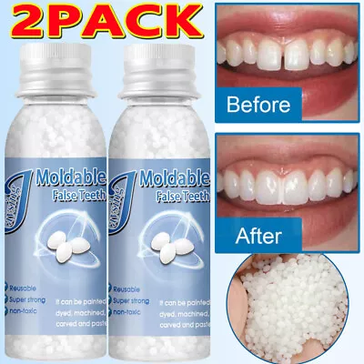 Temporary Tooth Repair Kit Temp Dental Repair Replace Missing Teeth DIY Moldable • $10.28