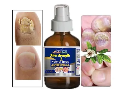 Anti-fungal Maximum Strength Toenail Fungus Athletes Foot Fungi Nail Support  • $8.99