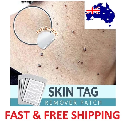 $9.99 • Buy Skin Tag Remover Acne Pimple Patch Removal Facial Care Spot Plaster AU STOCK