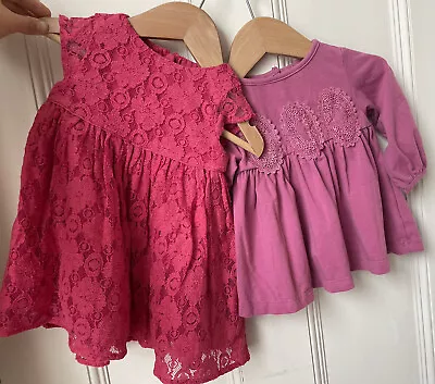 Calvin Klein M&S Baby Girl Lace Summer Dress Bundle 3-6 Months GUC • £2.95