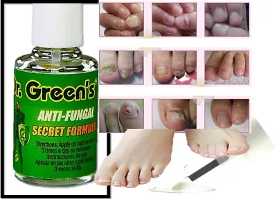 Anti Fungal Nail Support Fungu Nail Finger Toe Fungus Away • $9.26