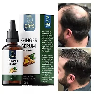 7 Days Ginger Hair Growth Essence Germinal Hair Growth Serum Essence Oil Hair Lo • $48.47