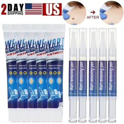 Wart Remover Pen Skin Tag Mole Remover Cream Eliminate Foot Corn Warts Unisex US • $8.03