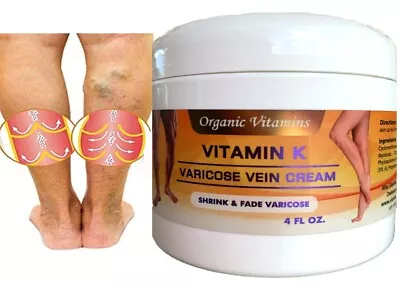 Vein Clear Herbal Cream | Vitamin K Vitamin E  A  Circulation Boosting 4oz • $14