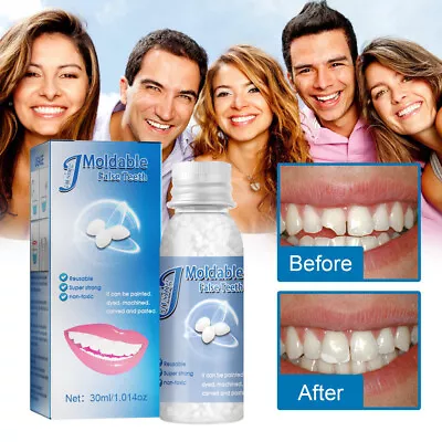 Resin Granules Tooth Gap Repair FalseTeeth Solid Glue Moldable Teeth And Gap UK • £7.95