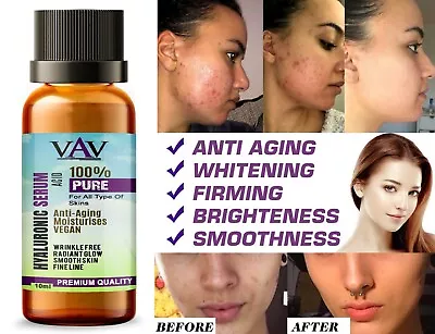 $8.03 • Buy Strong Anti Wrinkle Serum HYALURONIC ACID Ageing Collagen For Derma Roller 10ml