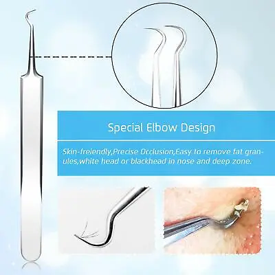 $5.99 • Buy Stainless Steel Blackhead Remover Curved Hook Tweezer Blemish Extractor Tool 1pc