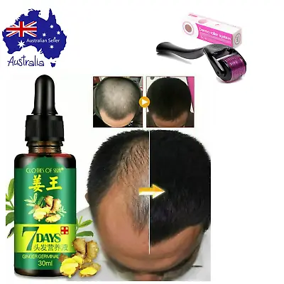 $14 • Buy Derma Roller (540/titanium 1.0mm) & Hair Growth Serum 7 Day (x1) DIY Home Beauty