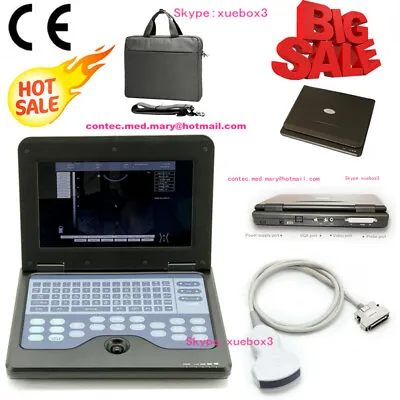 £1112 • Buy CONTEC Portable Ultrasound Scanner 3.5Mhz Convex Probe Digital Laptop Machine,CE
