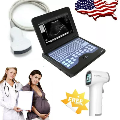 FDA CMS600P2 Portable Ultrasound Scanner Laptop Ultrasound Machine Convex Probe • $1249