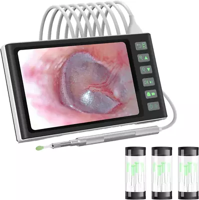 Digital Otoscope With 7.0 Inch Screen Hiacinto 3.9mm Ear Camera W/ 6 LED Lights • $133.99