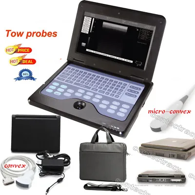 £1468 • Buy CE Digital Portable Ultrasound Scanner B Ultrasonic Machine+convex,micro Convex