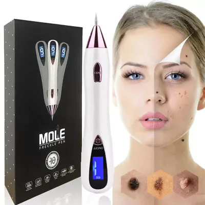 Anti-Aging Laser Plasma Pen Skin Mole Dark Spot Remover Machine Wart Tag Tattoo • $20.95