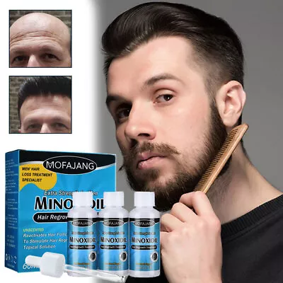£12.95 • Buy 3 Months Extras Strength Men's Regrowth Treatment Regain Hair Growth Solution