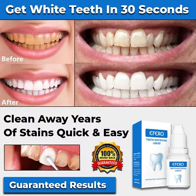 New Instant Tooth Whitening Kit White Teeth Clean Gel Uv Bleach Dental Strength • $26.95