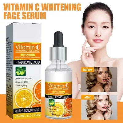 $7.26 • Buy Vitamin C Face Serum Whitening Brightening Skin Dark Spot Remover Care Essence.