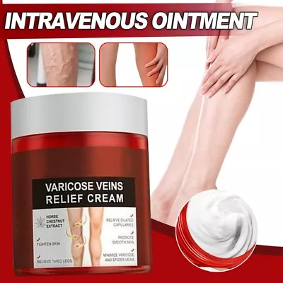 Treatment Legs Varicose Veins Cream Vein Care Fading Cream Herbal Ointment • £6.88