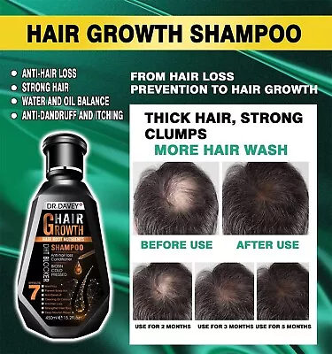 Hair Growth Shampoo Hair Thickening Shampoo Hair Loss Treatment For Men & Women • $18.75