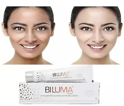 Biluma Cream Depigmentation Skin Whitening & Lightning Cream Melasma 15G • £12.95