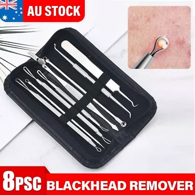 $8.45 • Buy Blackhead Remover 8 Piece Tool Kit For Pimple Extraction Blemish Suction Removal