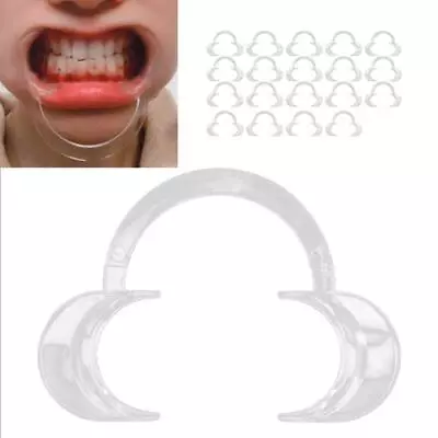 Dental Cheek Lip Retractor Teeth Whitening - Set Of 20 | Various Sizes • £10.54