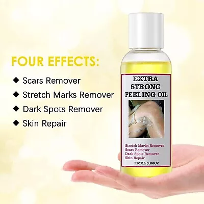 Extra Strong Peeling Oil Body Skin Brightening Exfoliating Peel Off Remover • $14.98