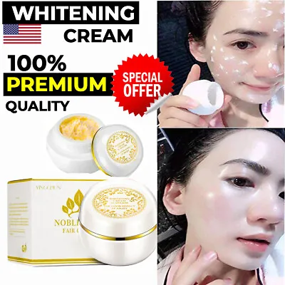 $15.98 • Buy Face Whitening Cream For Dark Skin Spots Scars Snow Day Night Face White Cream ✅