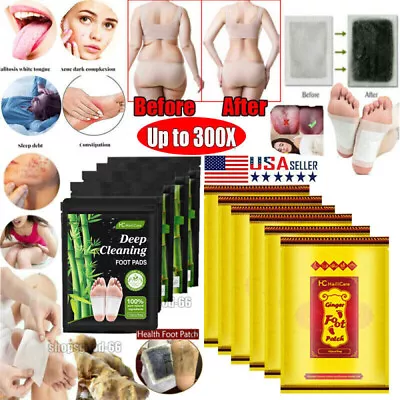 300PCS Detox Foot Patches Pads Body Toxins Feet Slimming Deep Cleansing Herbal • $44.75