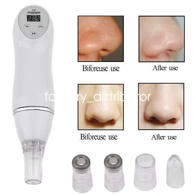 Diamond Dermabrasion Microdermabrasion Vacuum Peeling Skin Care Beauty Machine • $39.96