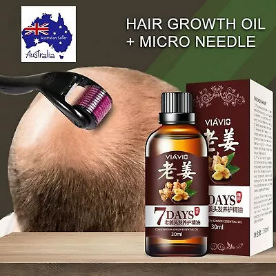 $14 • Buy Derma Roller (540/titanium 1.0mm) & Hair Growth Serum 7 Day (x1) DIY Home Beauty