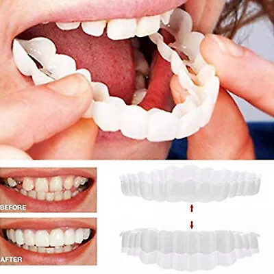 Adult SMILE Veneers Perfect Teeth Temporary Replacement Fake Teeth Cover Kit • $1.59