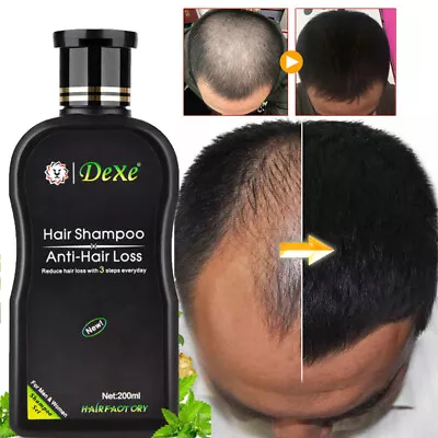 Fast Hair Growth Shampoo For Women Men Anti Hair Loss Treatment Care Thickening • £9.25