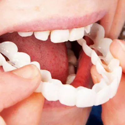 Snap On Pair Upper And Lower Smile Cosmetic Dental White Teeth Denture Veneers  • $18.44