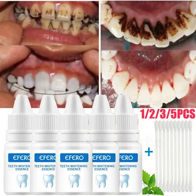$22.45 • Buy 5xTeeth Whitening Essence Cleaning Whiten Tooth Serum Remove Plaque Dental Care