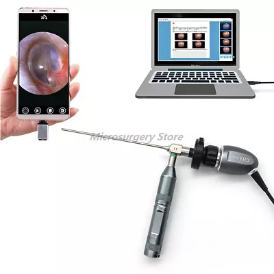 Portable Medical Endoscope Multi-outputs 1080P HD Camera With 60FPS Frame Rate • $640