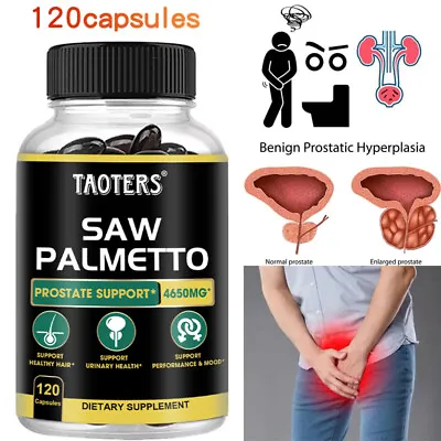 Saw Palmetto Extract 4650mg Per Capsules Prostate Hair Loss Urinary Tract • $13.85