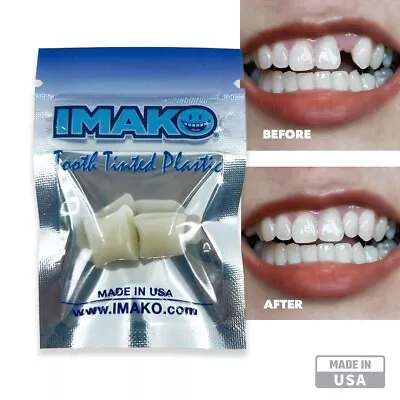 Imako® Tooth Tinted Plastic - Temporary Tooth - Fix Chipped Teeth Gaps In Teeth • $9.99