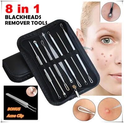 $3.78 • Buy Blackhead Extractor Tool Remover Pimple Blemish Comedone Acne Clip Facial Beauty