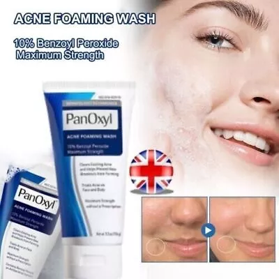 Acne Foaming Wash Face & Body 10% Active Ingredient 156g New UK 2024 • £8.35