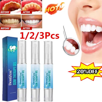 $6.44 • Buy Teeth Tooth Whitening Gel Pen Extra Strong White Hygiene Tooth Stain Remova 1-3x