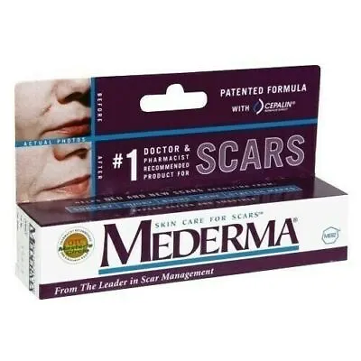 Mederma Cream - For Scars Surgery Injury Burns Acne Stretch Marks (10gm) • $21.23
