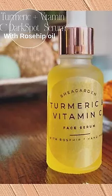 **Turmeric + Vitamin C + ROSEHIP Oil Dark Spot Serum  FREE SHIPPING ** • $15