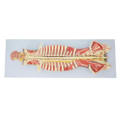 Intraspinal Spinal Cord And Spinal Nerve Nervous System Anatomy Medical Model • $269.10