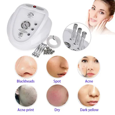 Diamond Microdermabrasion Dermabrasion Facial Skin Peel Vacuum Machine Skin Care • £96.88