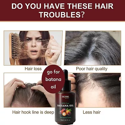 Batana Oil - For Hair Growth Dr Sebi Organic 100% Pure Concentrated Oil (30ml) • $19.79