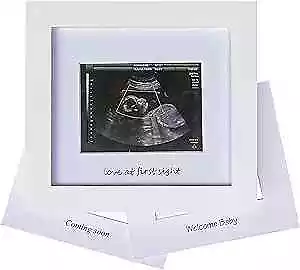  Baby Sonogram Photo Frame - 1st Ultrasound Picture Frame - Idea Gift For  • $17.51