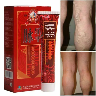 30g Varicose Veins Treatment Cream Ointment Leg Vasculitis Phlebitis Removal • $4.97